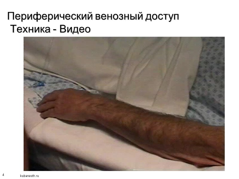 4 Периферический венозный доступ  Техника - Видео